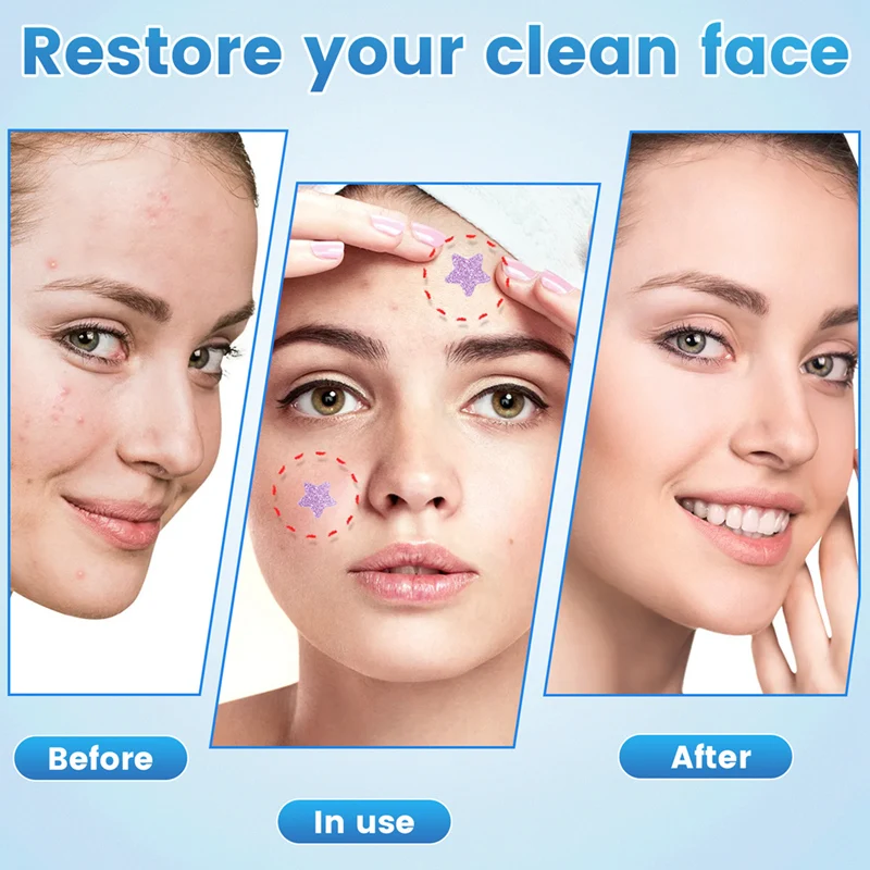 رقعة حب الشباب على شكل بثرة للوجه، رقع حب الشباب الغروانية المائية، ملصقات بقع ملونة (120 قطعة) + وردي + أحمر وردي