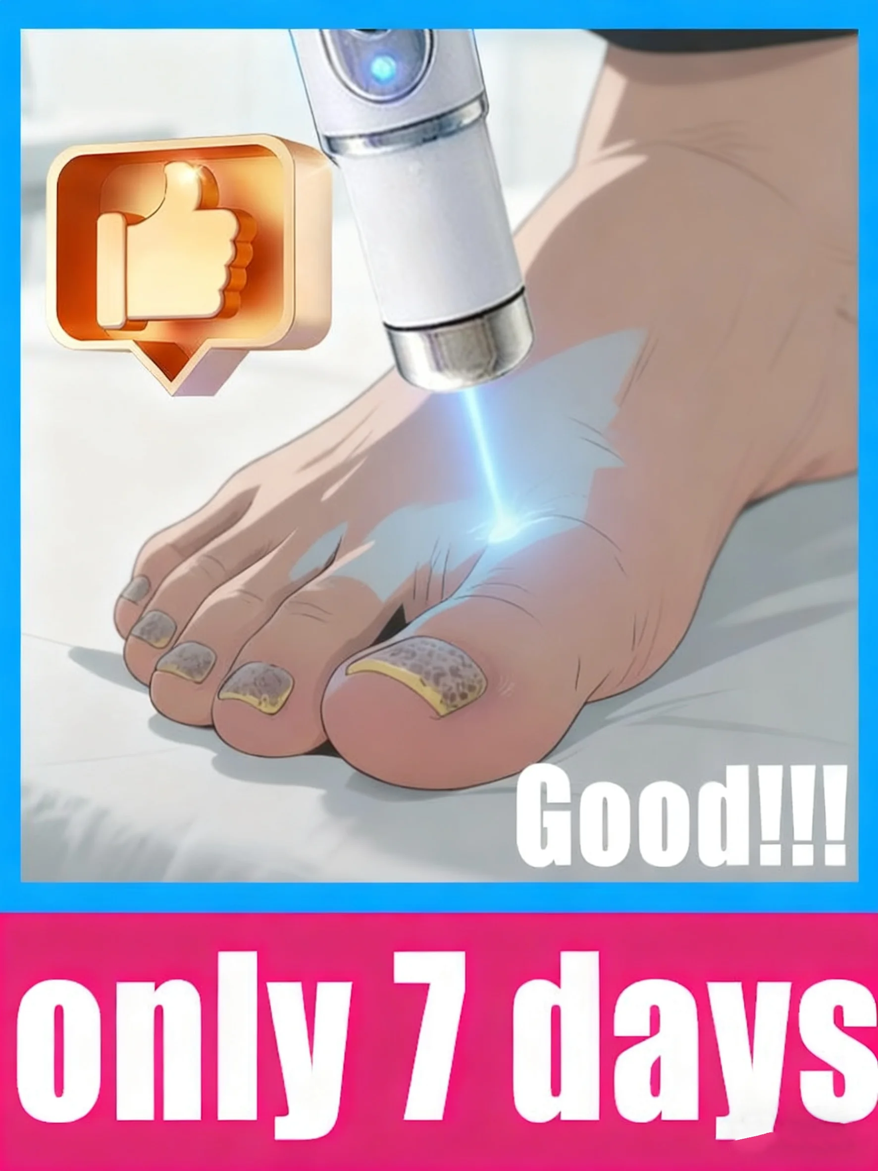 Heiße Verkäufer 2025, Nagelreinigungswerkzeuge, Blaulicht-Laserwerkzeuge, Wurzelreparatur, aufgerüstet auf die zweite Generation