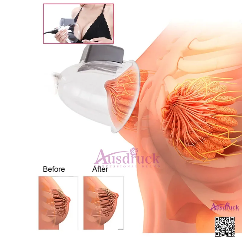 INFRARED LIGHT BUTTOCK LIFTING SUCKERS - Professional Body Shaping Tools for Enhanced Toning & Firmness - Ausdruck Brand