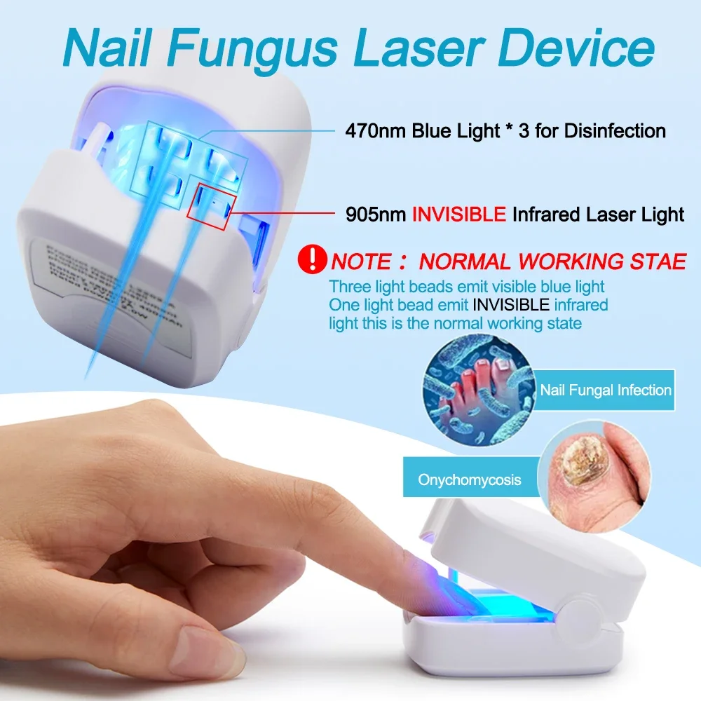 Nail Fungus Laser Treatment Device Repair Toenail Fingernail Fungus Treat Onychomycosis Laser Nails with Mushrooms Relaxation