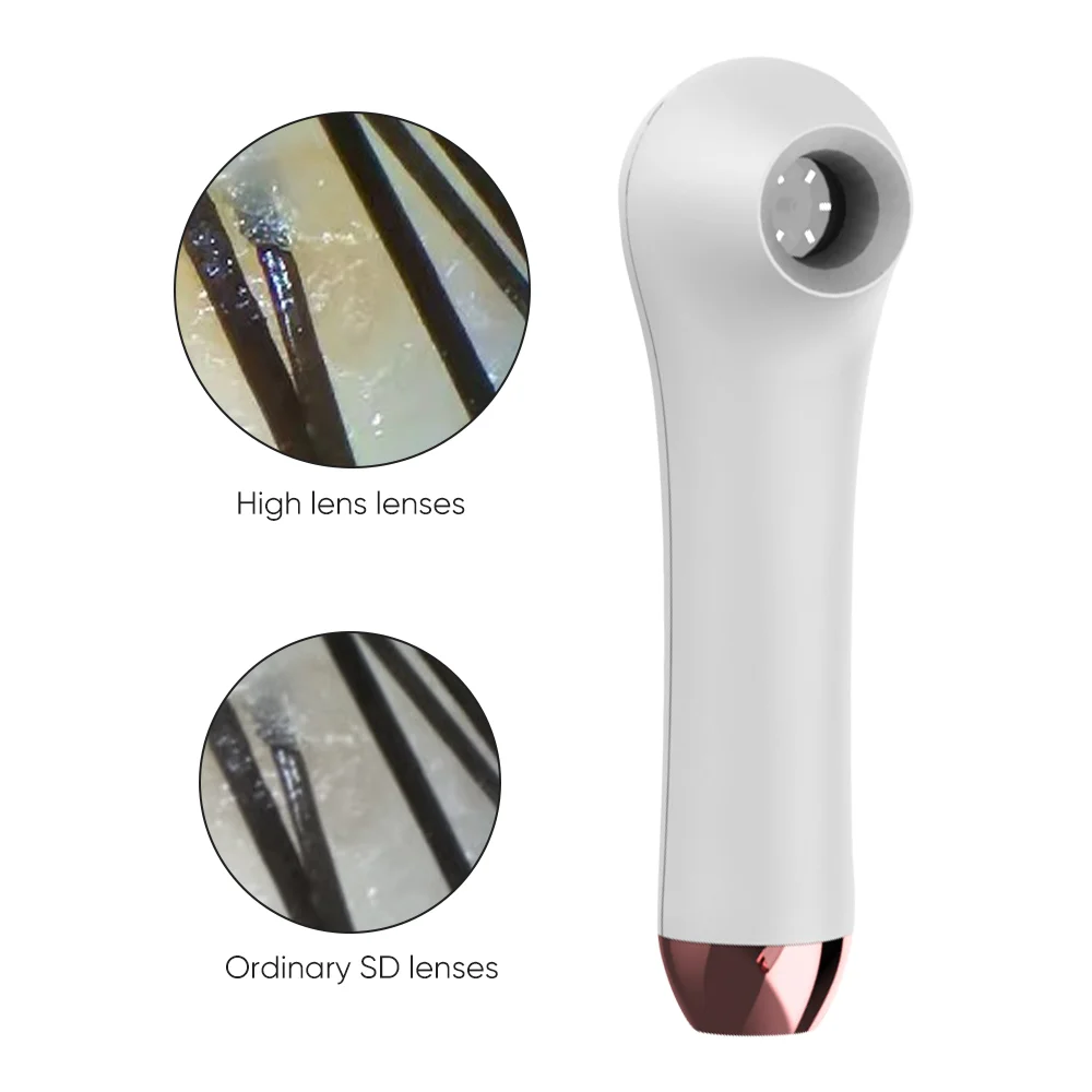 家庭用HD皮膚科フェイススキャナー スマート多機能肌・髪・頭皮検出器アナライザー（スキンケア分析用）