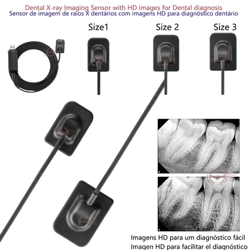 1 세트 치과용 X-ray 이미징 센서 더 빠르고 내구성이 뛰어난 USB RVG CMOS 센서 Size1 2 3 치과 진료소 진단용 HD 이미지 포함