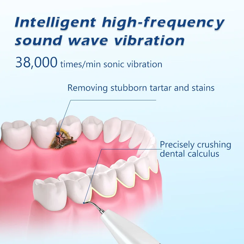 Visual Ultrasonic Scaler Dental Calculus Remover Teeth Plaque Scaler Stain Clean Electric Tooth Stone Removal Tartar Eliminator