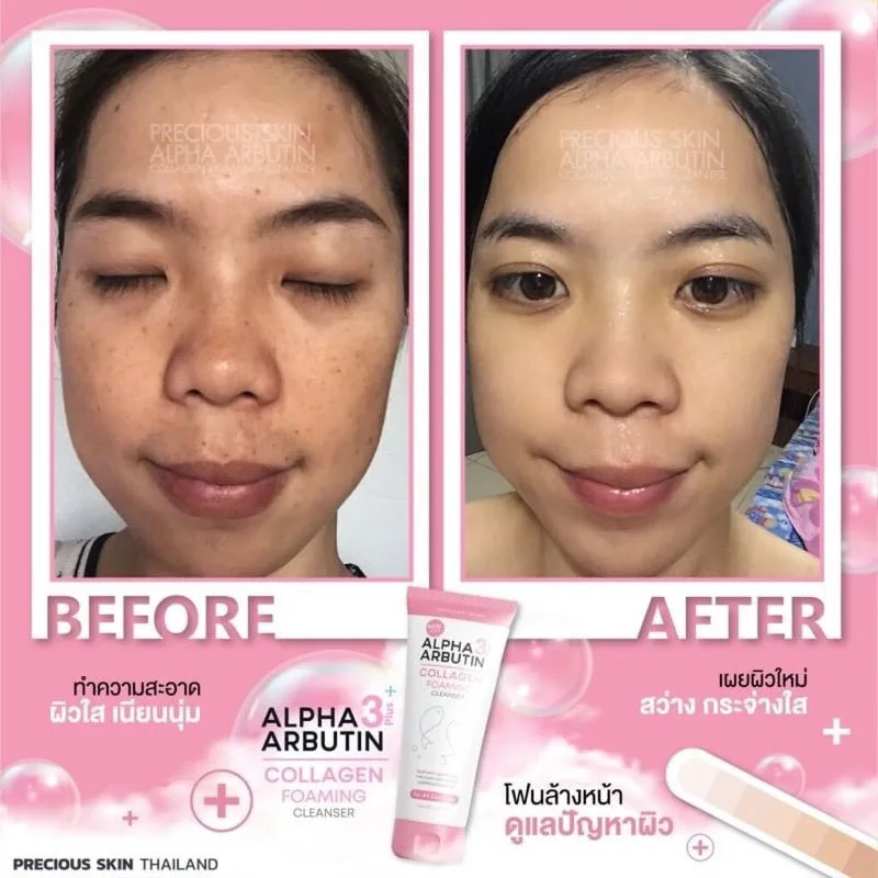 120ml Alpha Arbutin 3 Plus Collagen Cleanser Skin Blemishes Dark Spots Bright White Firmness Brightening and Even Skin Tone