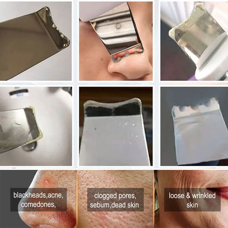 Limpador ultrassônico, purificador facial, massageador iônico ems para peeling facial, microcorrentes de levantamento para espátula de cuidados com a pele
