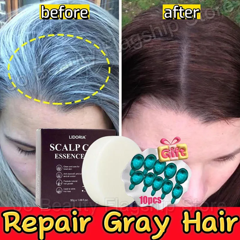 Gray White Hair Treatment Serum Soap Fast White To Black Repair Nourish Beard Hair Roots Shampoo Men Women Beauty Health Care