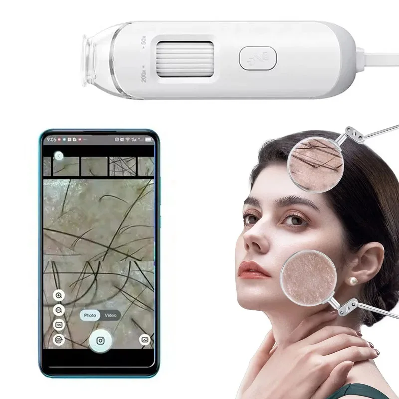 Electron Scalp Detection Pore Magnifier For Face Digital Microscope Camera Dermatoscope Skin Analyzer Machine Head Skin Analysis