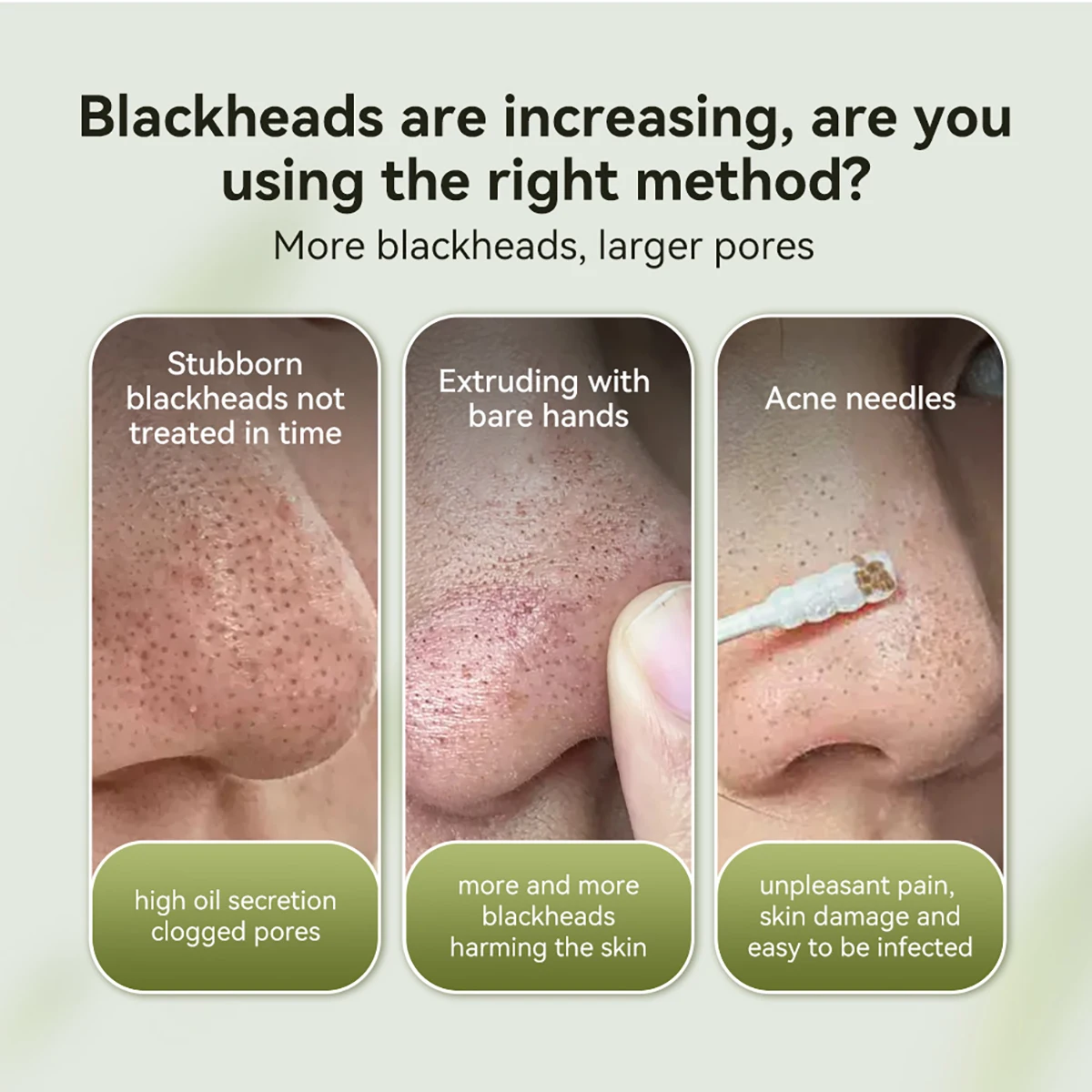 LANBENA Blackhead Remover Pore Cleaner Nose Strips With 60Pcs Paper For All Skin Stype Nose Mask
