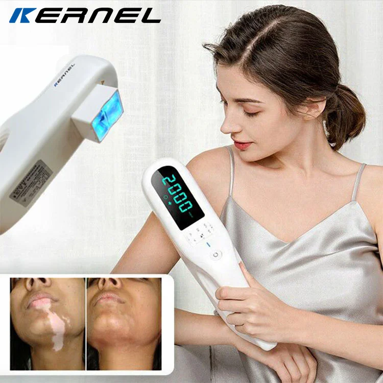 CE Approved Kernel KN-5000F UVB Phototherapy Treatment Portable 308nm Excimer Laser for Vitiligo