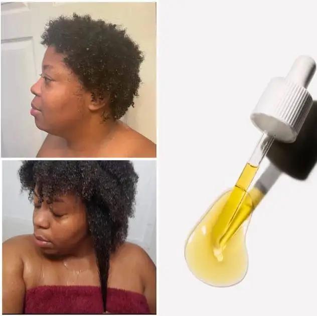 Amla Oil, Hair Oil, Rosemary Sage, Hair Oil, Black Castor Oil Hair Growth, Moisturizer, Black Seed Oil Chebe, Fenugreek Sea Moss