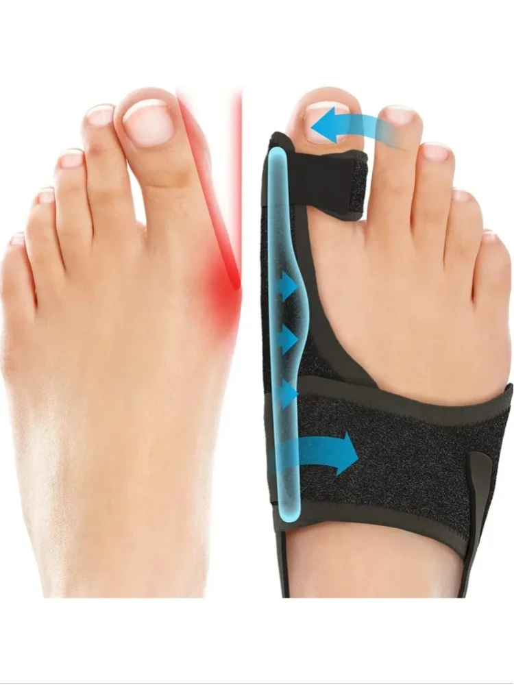 Orthopädische Hallux-Valgus-Korrekturschiene mit Zehenspreizer zur Schmerzlinderung – Nicht-chirurgische Korrektur für Hammerzehen und Hallux Valgus