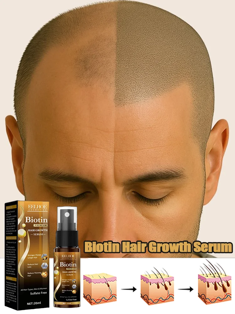 

20ml Biotin Hair Spray For Man Women Repair Damage Restore Oil Scalp Repair Serum Spray Thicken Hair Health Care New