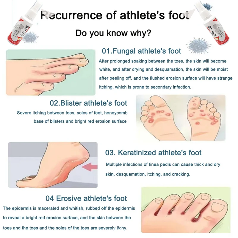 Shoe Shock Antibacterial Spray Foot Odor Shoes Stink Freshener Socks Odor Remover Spray Refresh Antiperspirant
