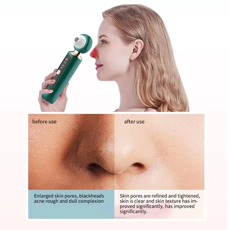 A66T-Electric Blackhead Remover USB Rechargeable Facial Blackhead Removal Instrument For Men's And Women's