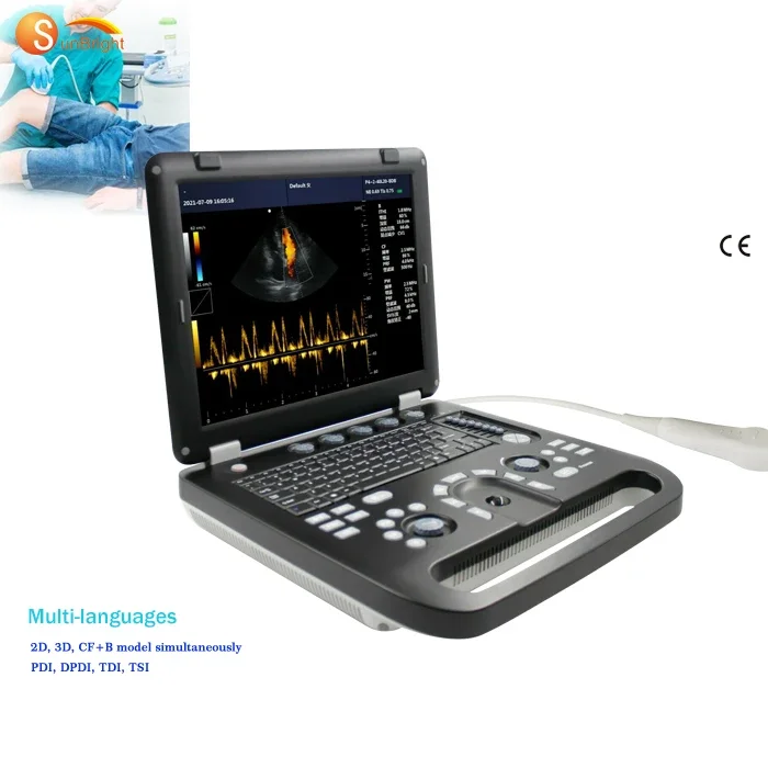 Professional color doppler SUN-906A 3D Portable ultrasound machine Medical color doppler device