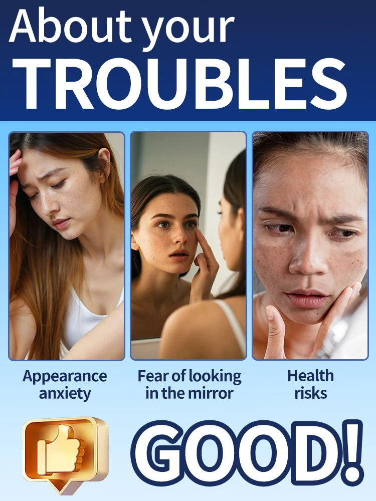 Die neue Paste 2025, sagt auf Melaninflecken, Patches, Pflegewerkzeuge