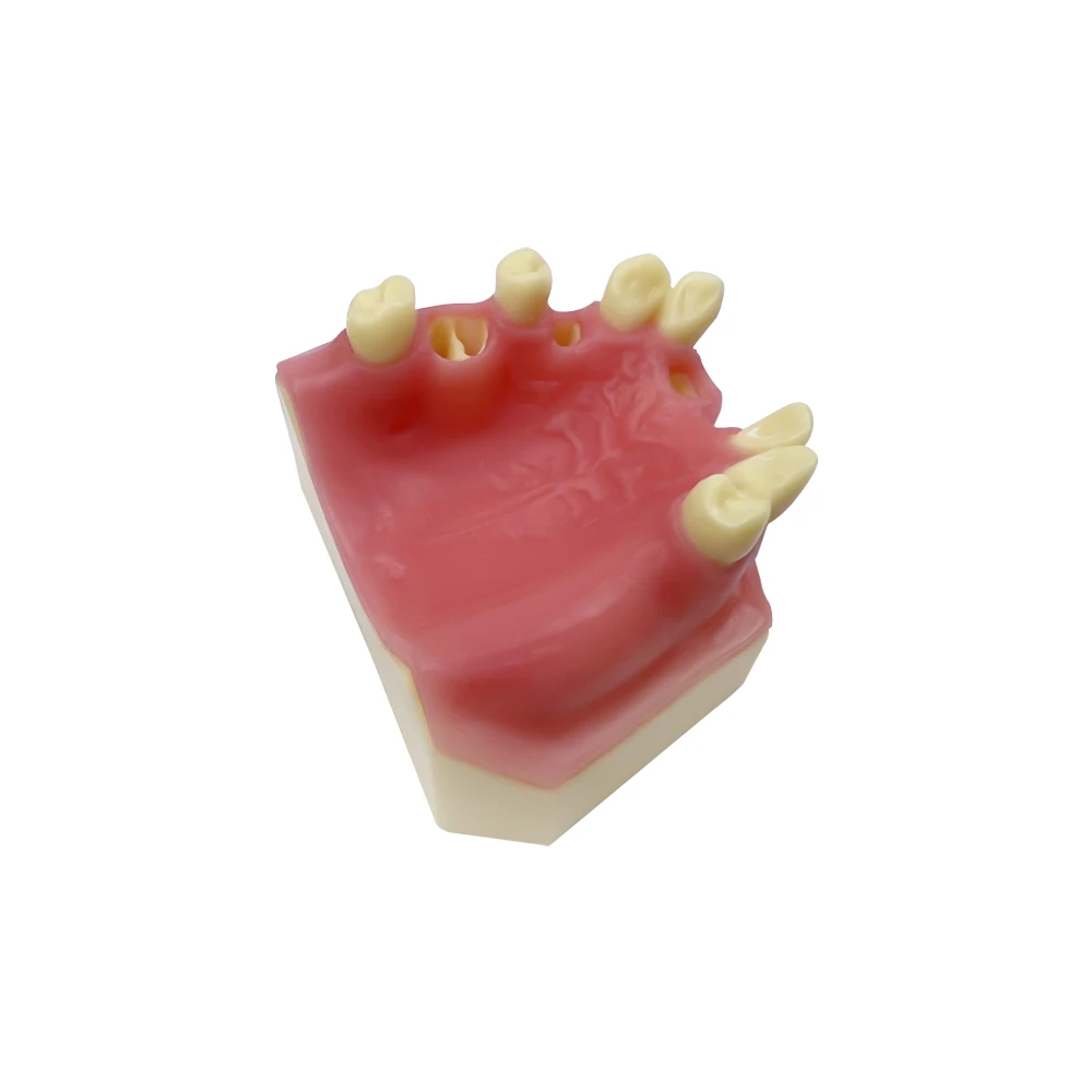 Teeth Model Maxillary Sinus Implant Practice Model of Missing Tooth for Dentist Technician Implant Teaching Studying Training