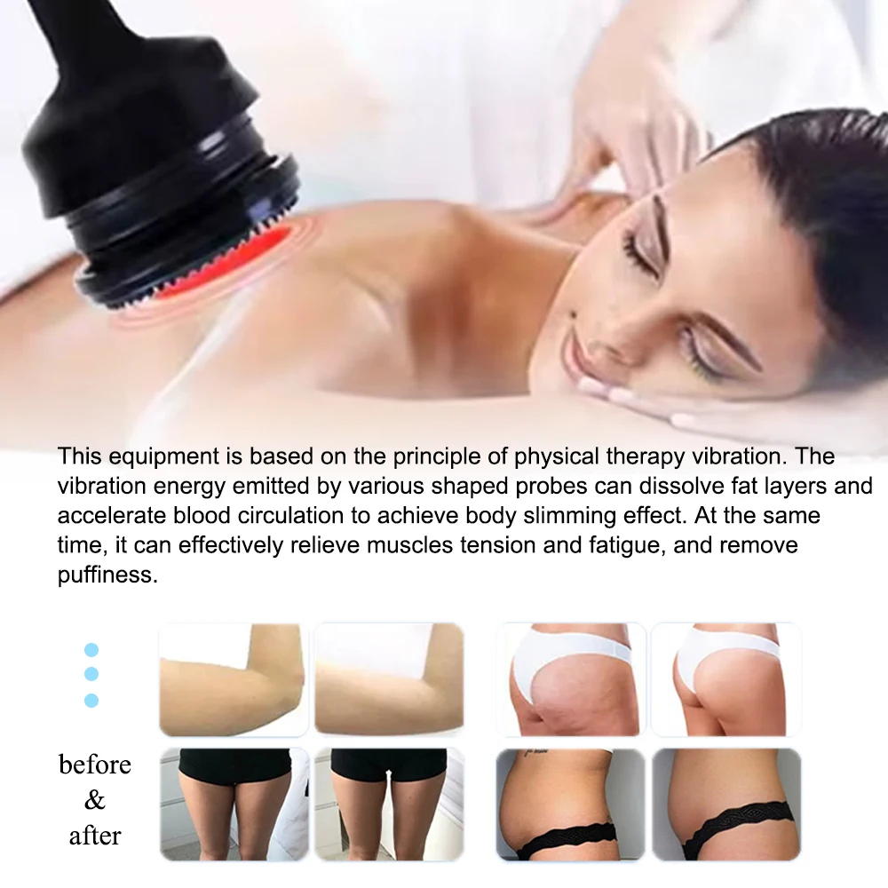Thumbnail 4 - #29 Best Electric Body Slimming Massagers to Buy In 2026
