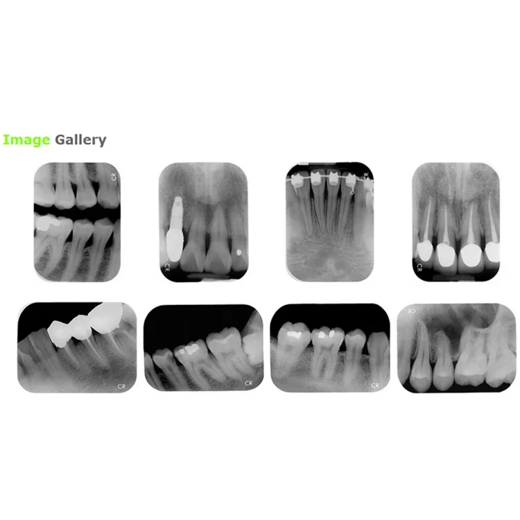 HY-C43 China Beste Prijs Den Tal Psp Scanner Te Koop