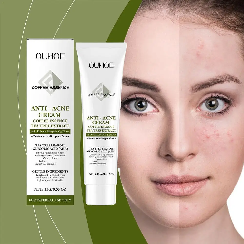 

Face Cream Acne Creams Mark Repair Firming Moisturizing Skincare Facial Cream