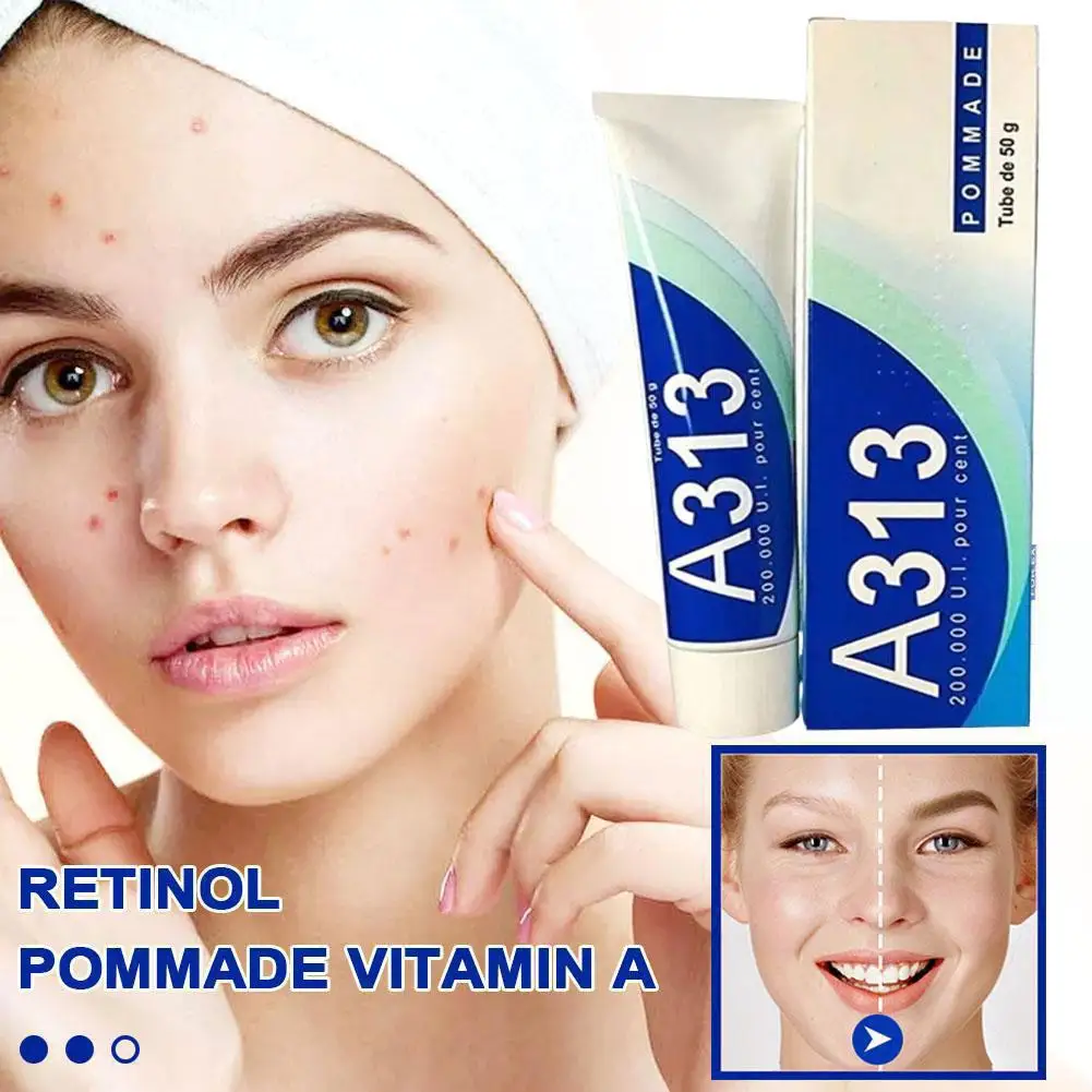 A313 Pure Vitamin A Retinol Cream 50g - Anti-Aging, Moisturizing, Acne Prevention with 200,000 IU Retinyl Palmitate for Face & D