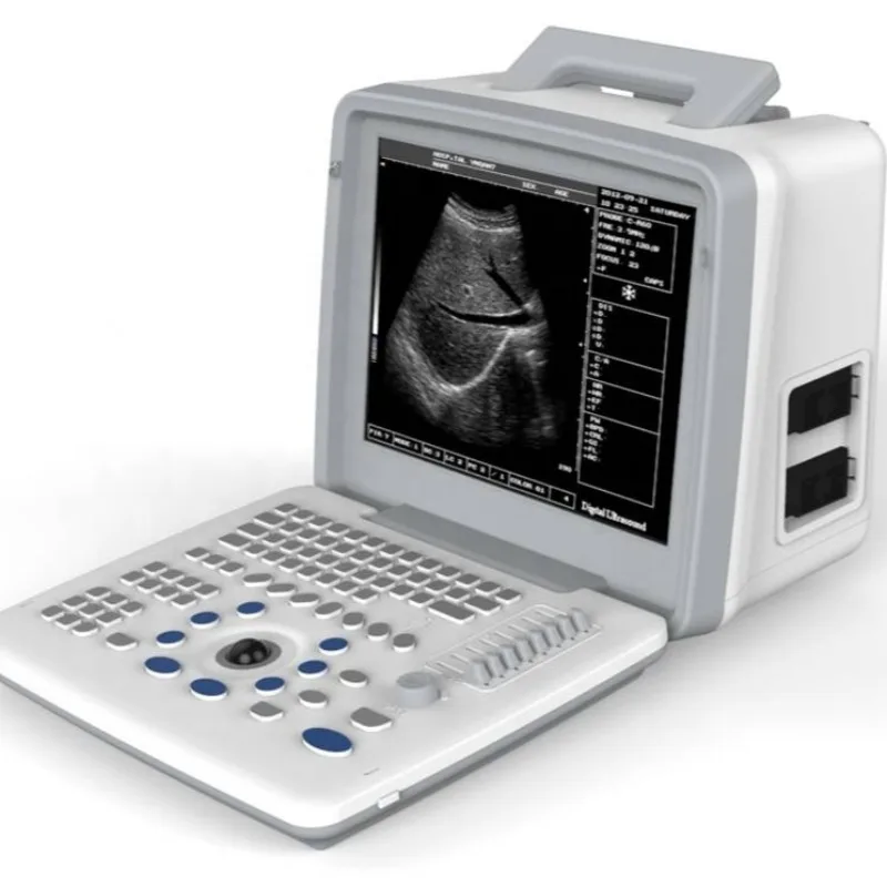 2026 Veterinary Potable Color Ultrasound Doppler Scanner Large Animal Vet Scan Ultrasound Hand Held Machine for Goats