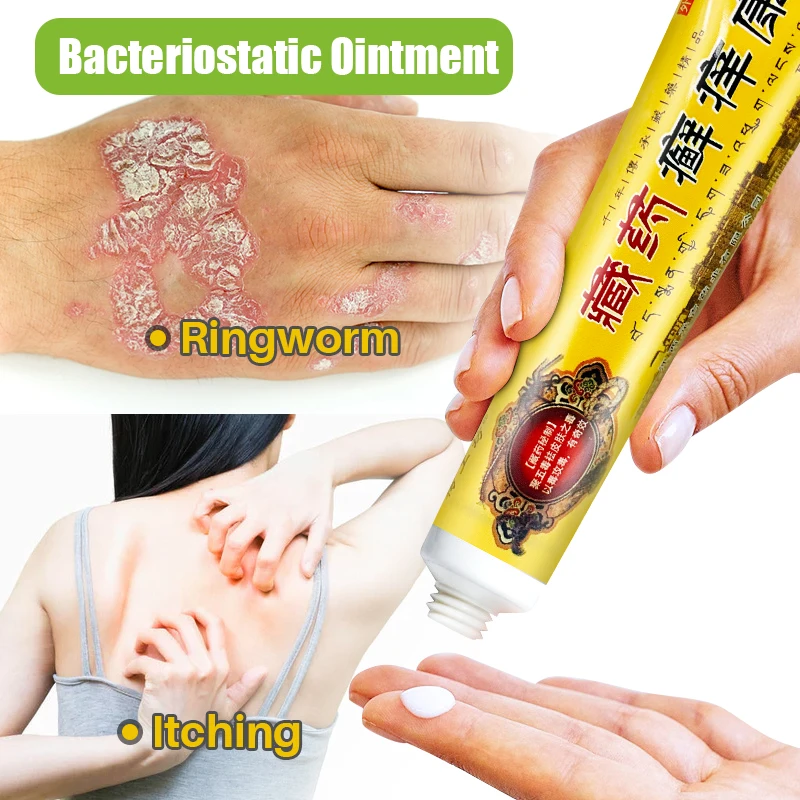 1Pcs Psoriasis Cream Antibacterial Herbal Plaster Dermatitis Eczematoid Eczema Ointment Treatment Psoriasis Skin Care Cream S050