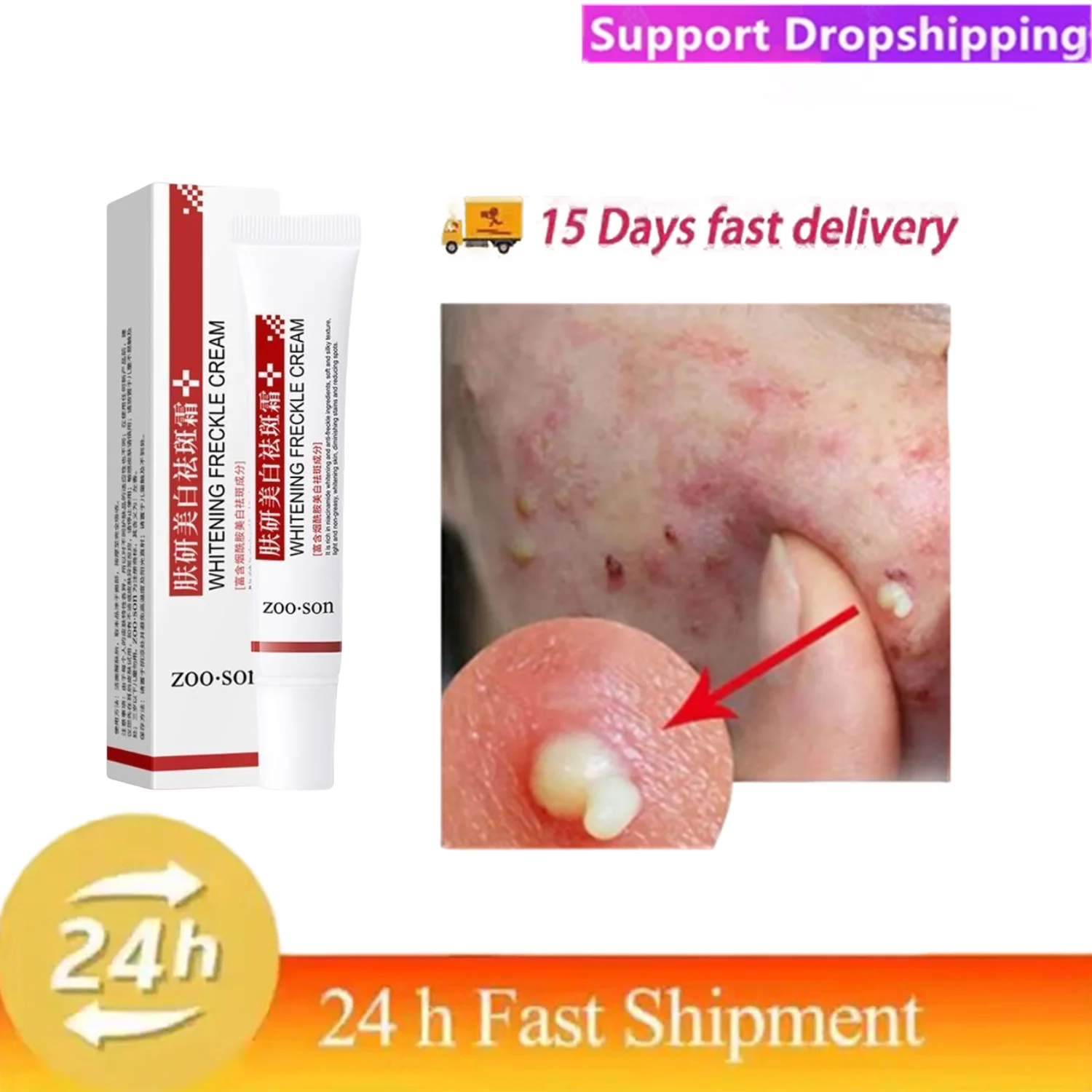 

Мощный отбеливающий крем для удаления пятен, осветляющий кожу, быстрое устранение пигментации меланина, мелазма, темные пятна, увлажняющий косметический гель