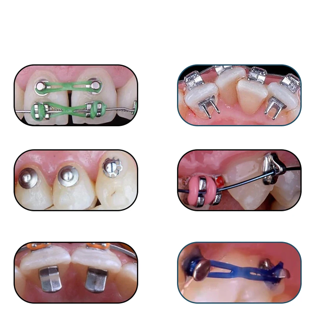 Bisagra Bondable de ortodoncia Dental, martillo de lengua, abridor de mordeduras Turbo, botones linguales, gancho de tracción, Materiales de