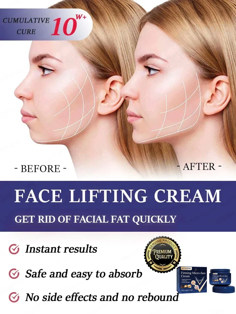 Remove Double Chin Cream