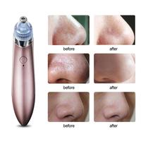 Blackhead Remover Beauty Instrument Cleaner Pore Vacuum Acne Pimple Black Spot Suction Electric Facial Skincare Exfoliating