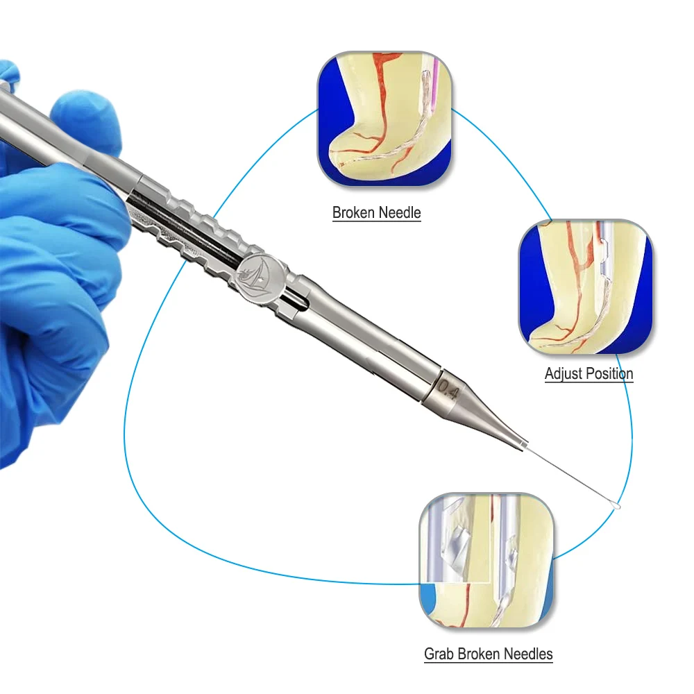 Zestaw narzędzi stomatologicznych do usuwania złamanych kanałów korzeniowych stomatologia Endo Restoration do usuwania złamanych pilników Endo