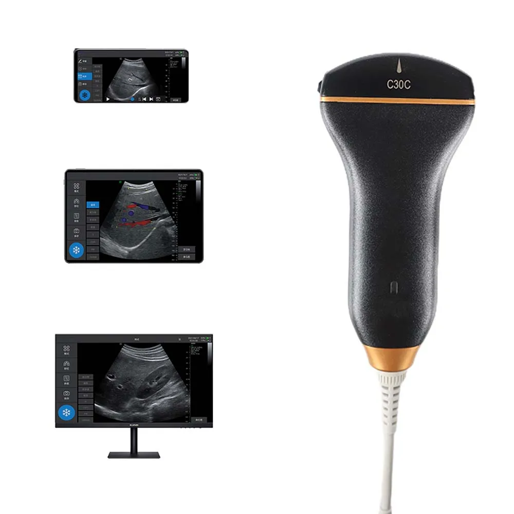 New style portable ultrasound for clinic ultrasound machine linear doppler ultrasound handheld device