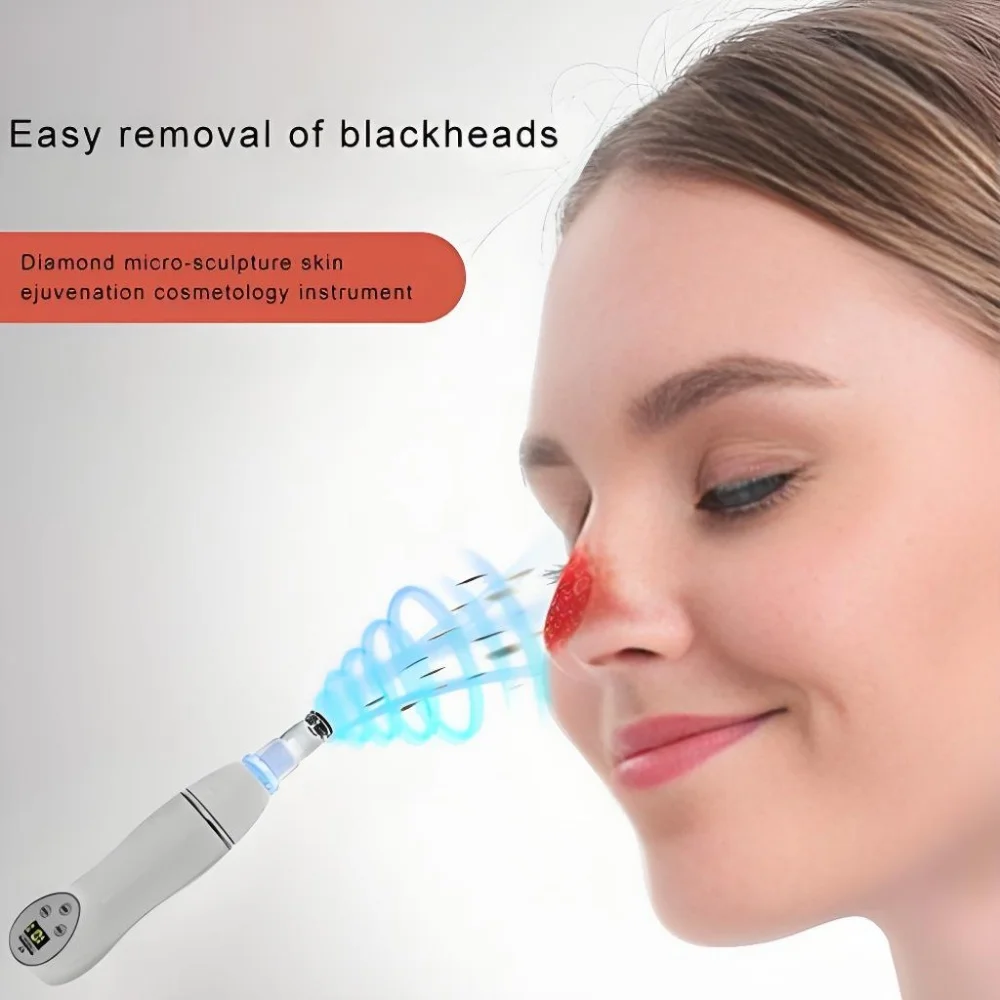 جهاز تقشير الجلد الماسي الصغير لتقشير الرؤوس السوداء، جهاز إزالة شفط الهواء، جهاز تجميل رقمي، منظف مسام الوجه