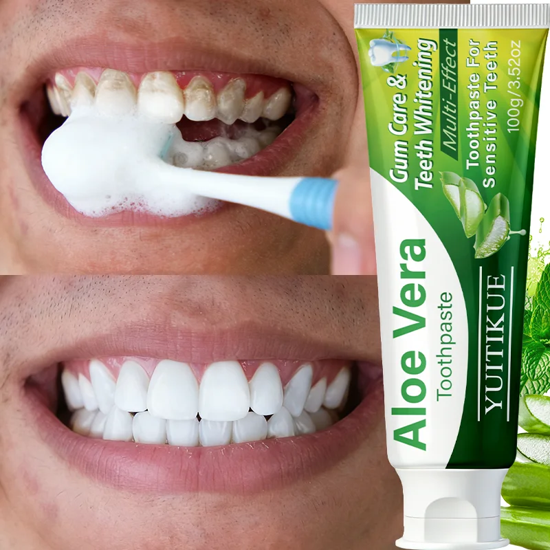 YUITIKUE Aloe Vera Toothpaste | Gum Care & Teeth Whitening for Sensitive Teeth | Multi-Effect Oral Care 100g