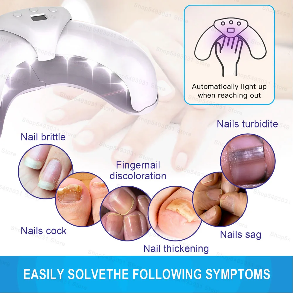 Toenail Fungal Nail Laser Treatment Repair Fast Nails Fungus Onychomycosis Repair Removes Foot Fingernail  Nail Fungus Device