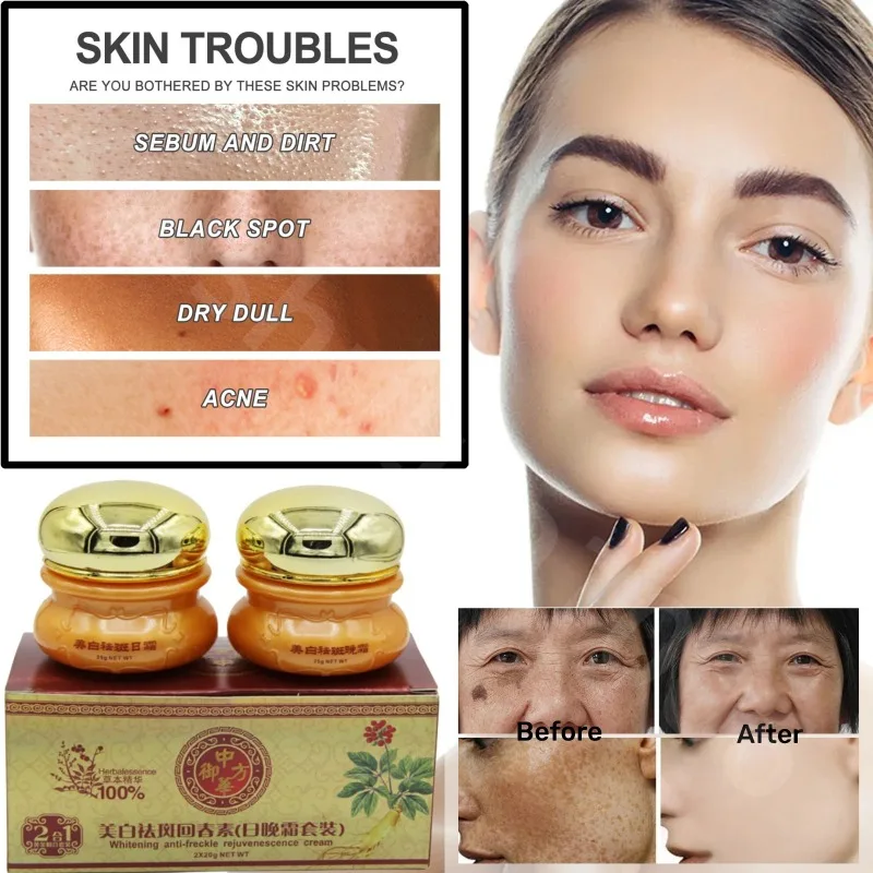 

Pimples Melasma Blemish Removal Dark Spot Remover Cream Strong Bleaching Whitening Face Freckles Remove Corrector Cream