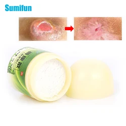 15g Bedsores Wound Healing Powder Removal Rot Myogenic Treat Pressure Sores Ulcer Festering Necrotic Dressing Cream Skin Care