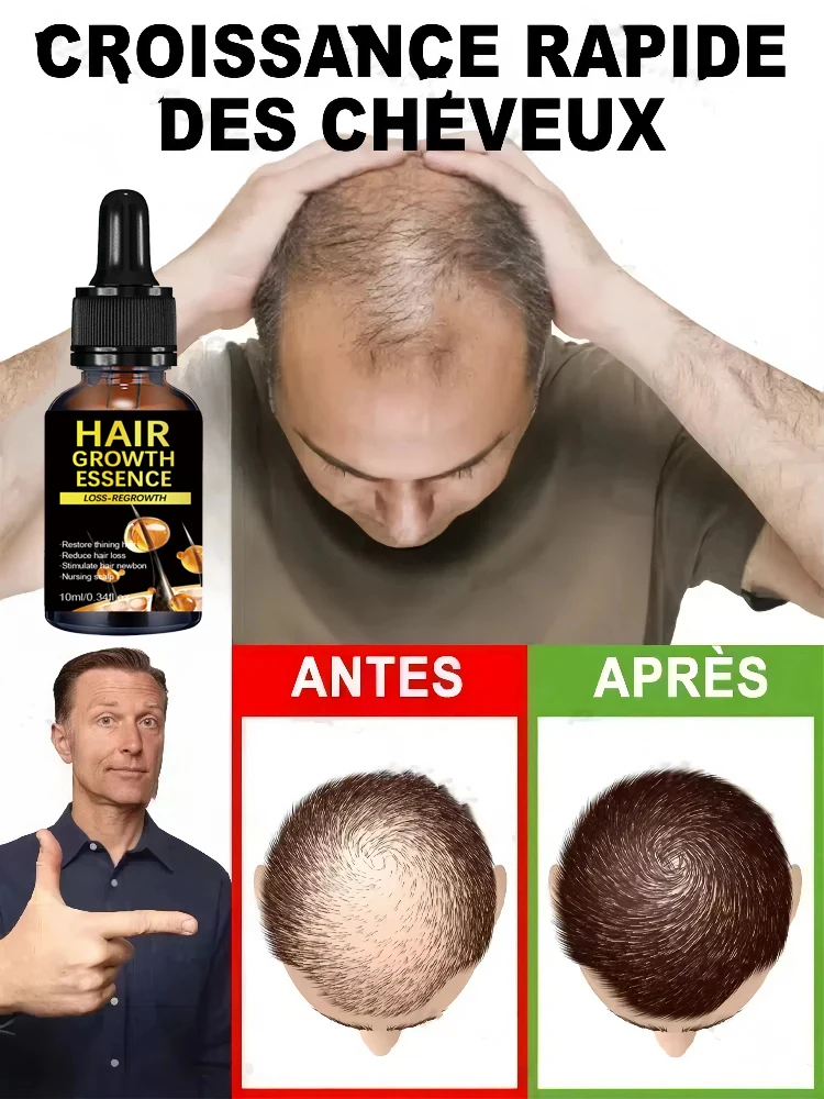 

Hot selling product,Rapid hair growth products that can effectively repair baldness and hair loss in 2025