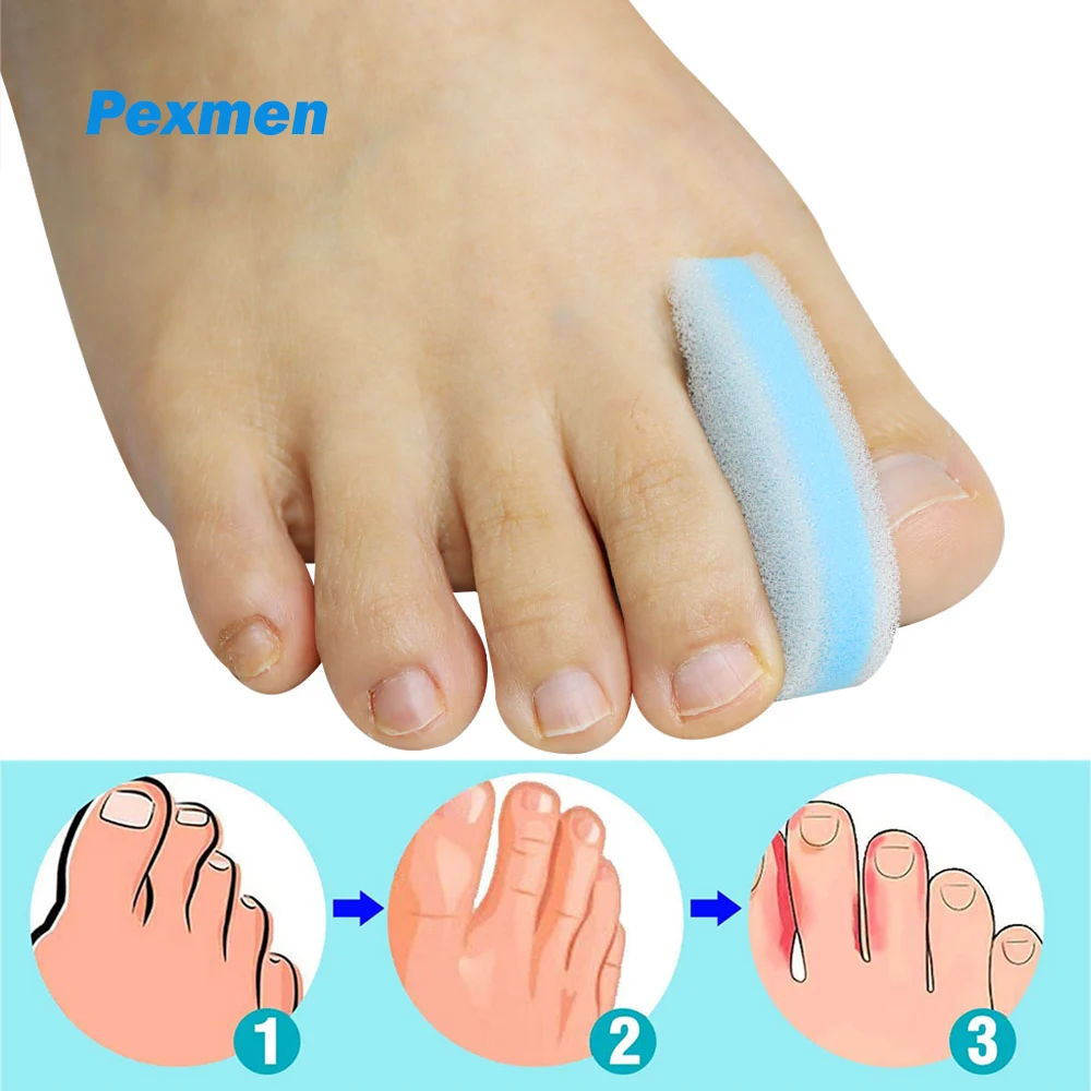 

Pexmen 2Pcs Foam Toe Spacers Toe Separator to Align Crooked Overlapping Toe Relieve Corn Blister and Reduce Toe Irritation