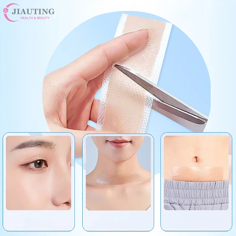 

Рулон силиконовой ленты для шрамов, силиконовые пластыри для шрамов, самоклеящаяся лента для маскировки шрамов, водонепроницаемая и дышащая, для ухода за кожей