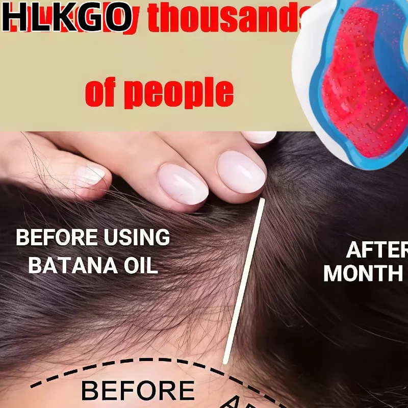 Men Hair Growth Laser Helmet, Anti Hair Loss Cap with Laser Treatment for Hair Regrowth and Scalp Health