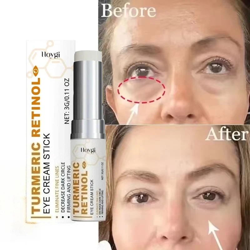 Instant Turmeric Eye Bag Removal Cream Hyaluronic Acid Anti-Wrinkle Firming Skin Fade Fine Lines Anti Dark Circle Puffiness 3g