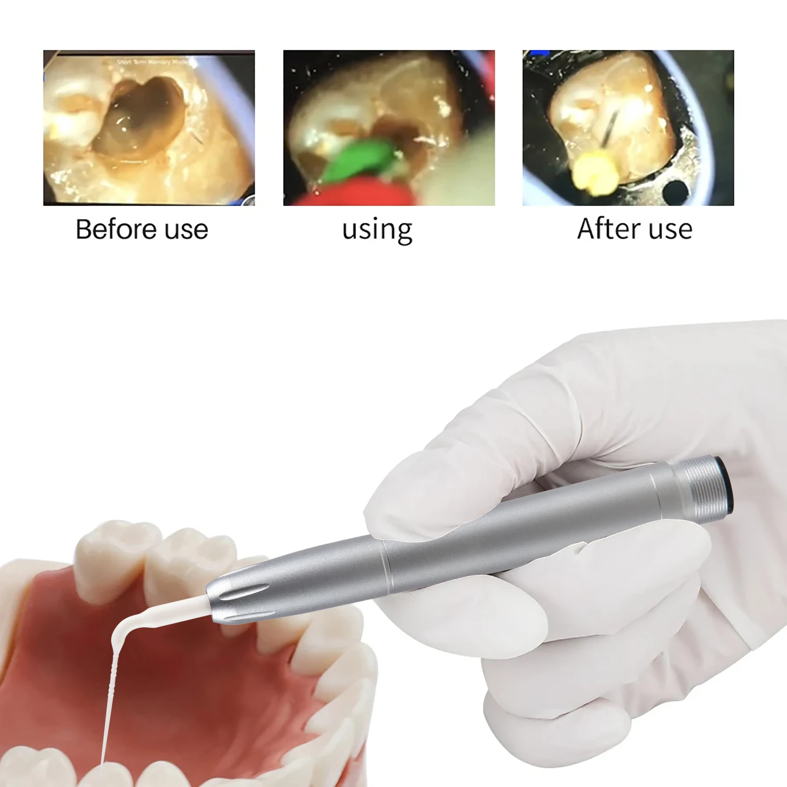 Dental Ultrasonic A…
