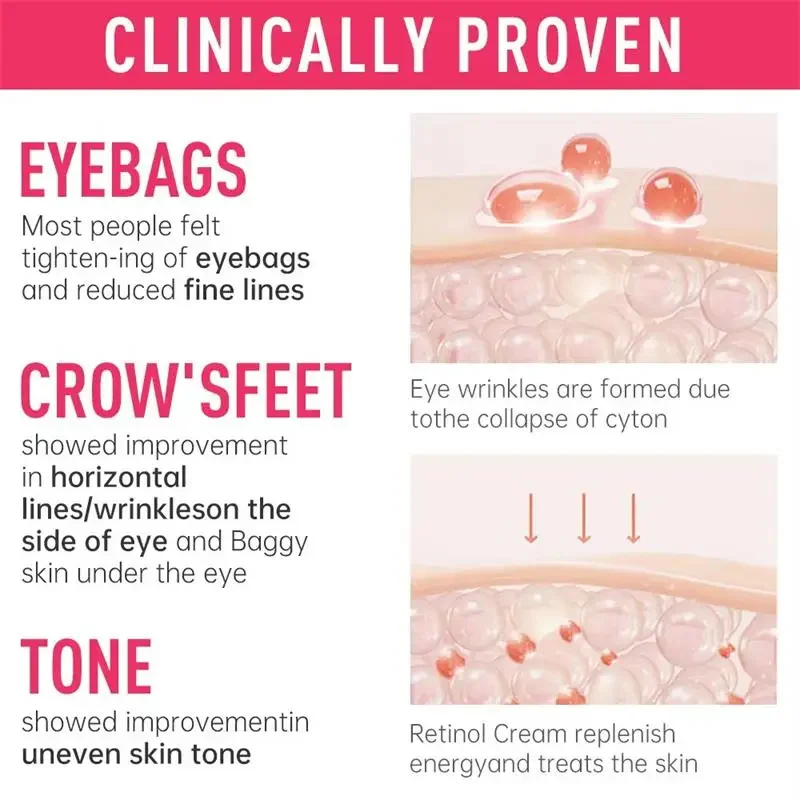 Crema per la rimozione istantanea delle borse per gli occhi Retinolo Antirughe Rassodante Pelle Dissolvenza Linee sottili Anti Cerchio scuro Gonfiore Illumina la cura degli occhi