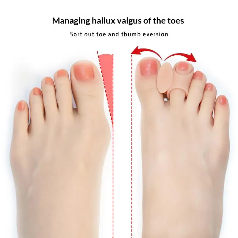 Komfortorientierte Silikon-Gel-Hallux-Valgus-Korrektoren für Tägliche Aktivitäten, Ideal zur Schmerzreduktion und -linderung – Detail 4