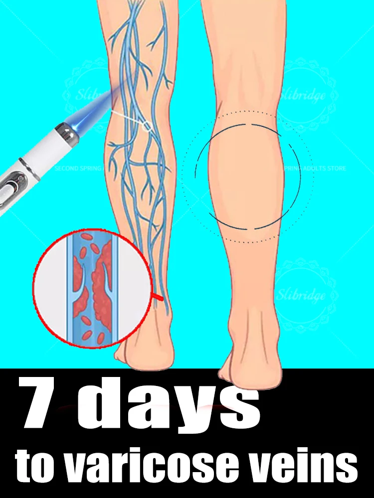 

Leg care tools eliminate spider leg varicose veins Vein blue light tool, more discounts on sets