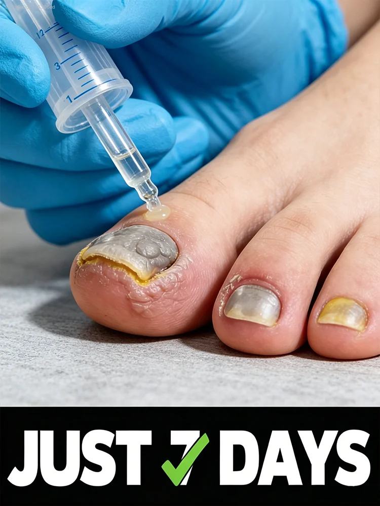 

Specialized for removing damaged nails, onychomycosis, and repairing yellowed, thickened, and cloudy nails.