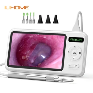 11 Main Sales Digital otoscope - №5