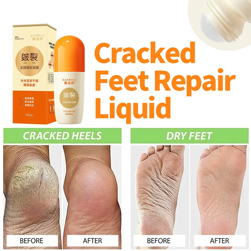 Anti Crack Foot Cream Drying Cracked Peeling Feet Repair Heel Chapped Mask Hand Dead Skin Removal Foot Moisturizing Care Dew